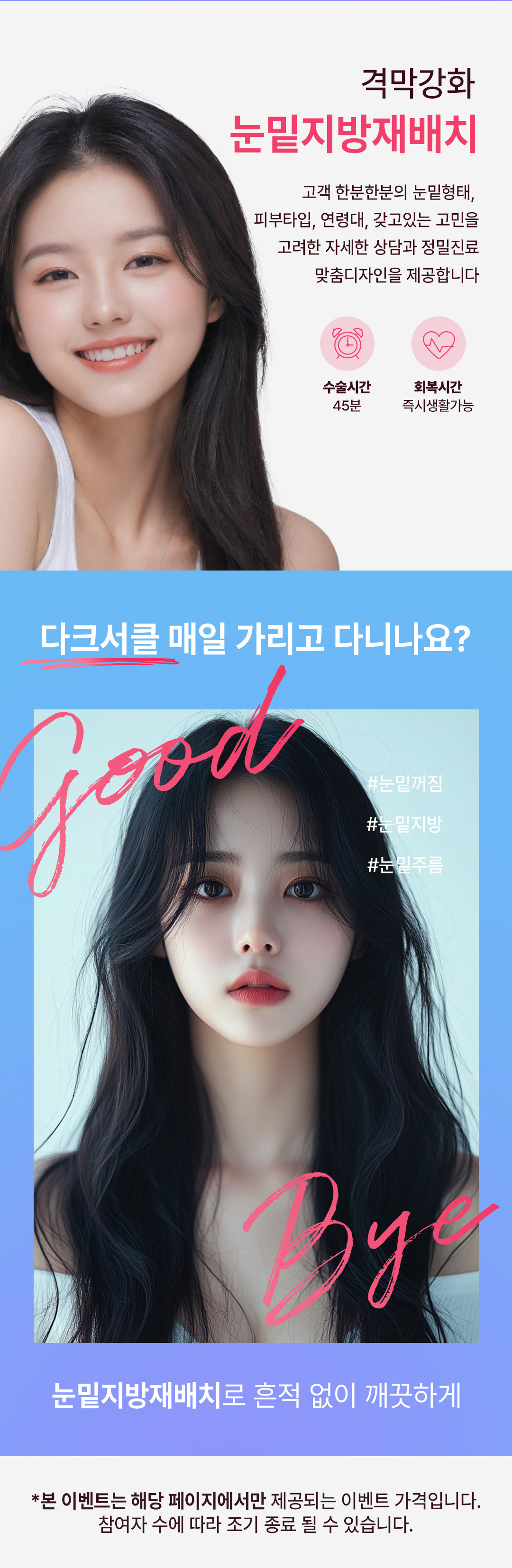눈밑지방재배치 이벤트 안내