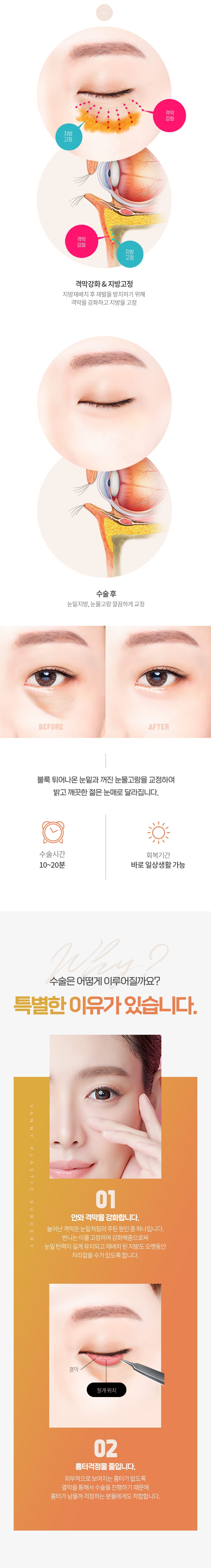 눈밑지방재배치 이벤트 안내