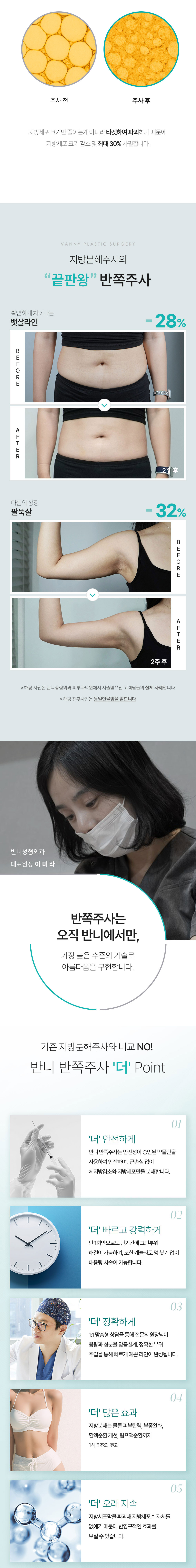 반쪽주사 이벤트 안내