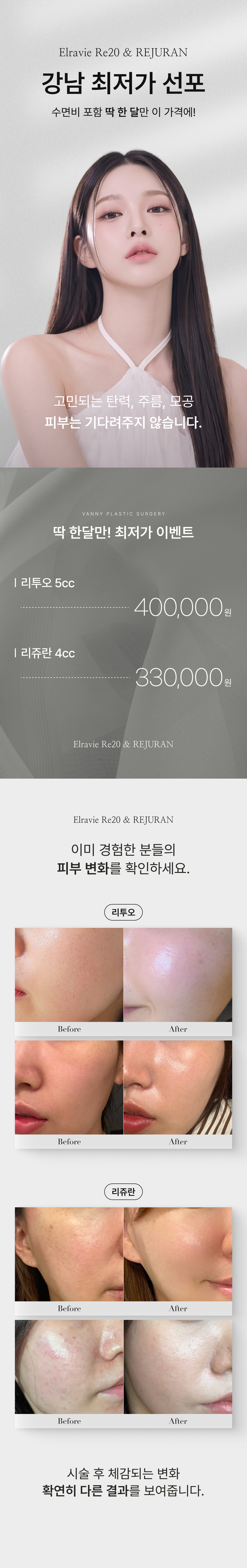 리투오40 · 리쥬란33 이벤트 안내